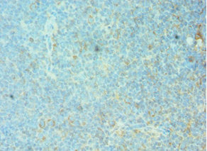 Immunohistochemistry of paraffin-embedded human tonsil tissue using the antibody at dilution of 1:100Rabbit anti-Human FOSL1 Polyclonal Antibody