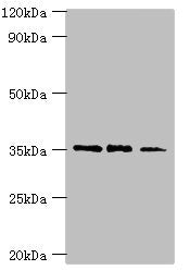 Western blot | All lanes: FOSL2 antibody at 8μg/ml | Lane 1: MCF-7 whole cell lysate | Lane 2: Jurkat whole cell lysate | Lane 3: PC-3 whole cell lysate | Secondary | Goat polyclonal to rabbit IgG at 1/10000 dilution | Predicted band size: 36, 35, 32 kDa | Observed band size: 36 kDaRabbit anti-Human FOSL2 Polyclonal Antibody