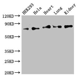 Western Blot | Positive WB detected in: HEK293 whole cell lysate, Hela whole cell lysate, Mouse heart tissue, Mouse lung tissue, Mouse kidney tissue | All lanes: FOXK1 antibody at 2.5μg/ml | Secondary | Goat polyclonal to rabbit IgG at 1/50000 dilution | Predicted band size: 76, 60 kDa | Observed band size: 76 kDaRabbit anti-Human FOXK1 Polyclonal Antibody