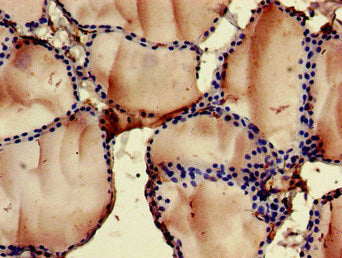 Immunohistochemistry of paraffin-embedded human thyroid tissue using FOXN1 Antibody at dilution of 1:100Rabbit anti-Human FOXN1 Polyclonal Antibody