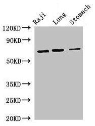 Western Blot  | Positive WB detected in: Raji whole cell lysate, Mouse lung tissue, Mouse stomach tissue  | All lanes: FOXN1 antibody at 2.7µg/ml  | Secondary  | Goat polyclonal to rabbit IgG at 1/50000 dilution  | Predicted band size: 69 kDa  | Observed band size: 69 kDaRabbit anti-Human FOXN1 Polyclonal Antibody