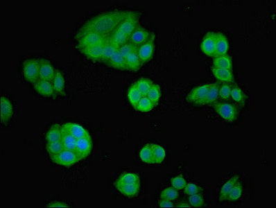 Immunofluorescent analysis of PC-3 cells using FOXP1 Antibody at dilution of 1:100 and Alexa Fluor 488-congugated AffiniPure Goat Anti-Rabbit IgG(H+L)Rabbit anti-Human FOXP1 Polyclonal Antibody