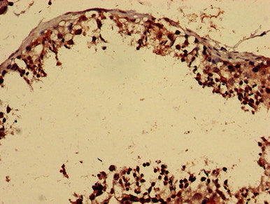 Immunohistochemistry analysis of human testis tissue using FOXP1 Antibody at dilution of 1:100Rabbit anti-Human FOXP1 Polyclonal Antibody