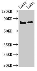 Western Blot | Positive WB detected in: Rat lung tissue, Mouse lung tissue | All lanes: FOXP1 antibody at 2μg/ml | Secondary | Goat polyclonal to rabbit IgG at 1/50000 dilution | Predicted band size: 76, 55, 66, 75, 13, 67, 78 kDa | Observed band size: 76 kDaRabbit anti-Human FOXP1 Polyclonal Antibody