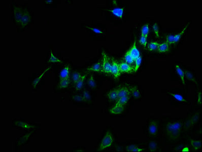 Immunofluorescence staining of HepG2 cells with SULT1A3 Antibody at 1:166, counter-stained with DAPI. The cells were fixed in 4% formaldehyde, permeabilized using 0.2% Triton X-100 and blocked in 10% normal Goat Serum. The cells were then incubated with the antibody overnight at 4°C. The secondary antibody was Alexa Fluor 488-congugated AffiniPure Goat Anti-Rabbit IgG(H+L).Rabbit anti-Human SULT1A3 Polyclonal Antibody