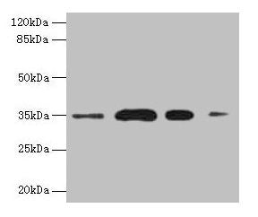 Western blot  | All lanes: SULT1A3 antibody at 20µg/ml  | Lane 1: A549 whole cell lysate  | Lane 2: Colo320 whole cell lysate  | Lane 3: Mouse brain tissue  | Lane 4: Mouse kidney tissue  | Secondary  | Goat polyclonal to rabbit IgG at 1/10000 dilution  | Predicted band size: 35, 23 kDa  | Observed band size: 35 kDaRabbit anti-Human SULT1A3 Polyclonal Antibody