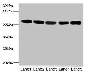 Western blot | All lanes: FRKantibody at 3.13μg/ml | Lane 1: Hela whole cell lysate | Lane 2: 293T whole cell lysate | Lane 3: K562 whole cell lysate | Lane 4: MCF-7 whole cell lysate | Lane 5: HepG2 whole cell lysate | Secondary | Goat polyclonal to rabbit IgG at 1/10000 dilution | Predicted band size: 59, 42 kDa | Observed band size: 59 kDaRabbit anti-Human FRK Polyclonal Antibody
