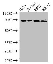 Western Blot  | Positive WB detected in: Hela whole cell lysate, Jurkat whole cell lysate, K562 whole cell lysate, MCF-7 whole cell lysate  | All lanes: CANX antibody at 2.7μg/ml  | Secondary  | Goat polyclonal to rabbit IgG at 1/50000 dilution  | Predicted band size: 68, 72, 56 kDa  | Observed band size: 88 kDa