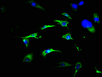 Immunofluorescence staining of U251 cells with the antibody at 1:466, counter-stained with DAPI. The cells were fixed in 4% formaldehyde, permeabilized using 0.2% Triton X-100 and blocked in 10% normal Goat Serum. The cells were then incubated with the antibody overnight at 4°C. The secondary antibody was Alexa Fluor 488-congugated AffiniPure Goat Anti-Rabbit IgG(H+L).Rabbit anti-Human FRS3 Polyclonal Antibody
