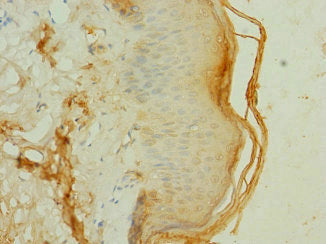 Immunohistochemistry of paraffin-embedded human skin tissue using FRS3 Antibody at dilution of 1:100Rabbit anti-Human FRS3 Polyclonal Antibody
