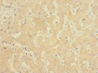 Immunohistochemistry of paraffin-embedded human liver tissue using FTCD Antibody at dilution of 1:100Rabbit anti-Human FTCD Polyclonal Antibody