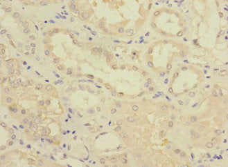 Immunohistochemistry of paraffin-embedded human kidney tissue using FTCD Antibody at dilution of 1:100Rabbit anti-Human FTCD Polyclonal Antibody
