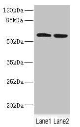 Western blot | All lanes: FTCD antibody at 5.46μg/ml | Lane 1: HepG2 whole cell lysate | Lane 2: 293T whole cell lysate | Secondary | Goat polyclonal to rabbit IgG at 1/10000 dilution | Predicted band size: 59, 62, 53, 17 kDa | Observed band size: 59 kDaRabbit anti-Human FTCD Polyclonal Antibody