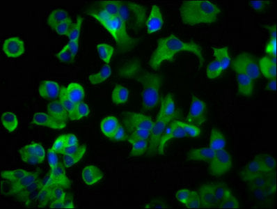 Immunofluorescence staining of MCF-7 cells with LRP2 Antibody at 1:200, counter-stained with DAPI. The cells were fixed in 4% formaldehyde, permeabilized using 0.2% Triton X-100 and blocked in 10% normal Goat Serum. The cells were then incubated with the antibody overnight at 4°C. The secondary antibody was Alexa Fluor 488-congugated AffiniPure Goat Anti-Rabbit IgG(H+L).