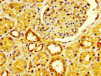 IHC image of the antibody diluted at 1:600 and staining in paraffin-embedded human kidney tissue performed on a Leica BondTM system. After dewaxing and hydration, antigen retrieval was mediated by high pressure in a citrate buffer (pH 6.0). Section was blocked with 10% normal goat serum 30min at RT. Then primary antibody (1% BSA) was incubated at 4°C overnight. The primary is detected by a biotinylated secondary antibody and visualized using an HRP conjugated SP system.