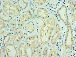 Immunohistochemistry of paraffin-embedded human kidney tissue using FUT6 Antibody at dilution of 1:100Rabbit anti-Human FUT6 Polyclonal Antibody