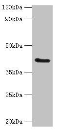 Western blot | All lanes: FUT6 antibody at 4μg/ml + Hela whole cell lysate | Secondary | Goat polyclonal to rabbit IgG at 1/10000 dilution | Predicted band size: 42, 43 kDa | Observed band size: 42 kDaRabbit anti-Human FUT6 Polyclonal Antibody