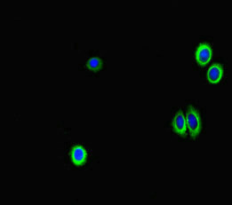 Immunofluorescent analysis of HepG2 cells using GAA Antibody at dilution of 1:100 and Alexa Fluor 488-congugated AffiniPure Goat Anti-Rabbit IgG(H+L)Rabbit anti-Human GAA Polyclonal Antibody
