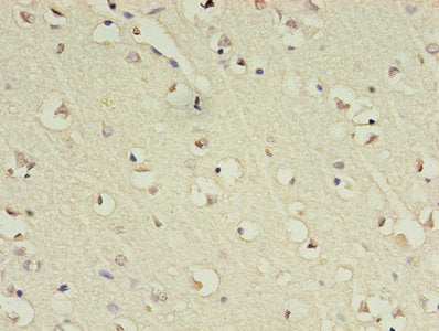 Immunohistochemistry of paraffin-embedded human brain tissue using GABRA4 Antibody at dilution of 1:100Rabbit anti-Human GABRA4 Polyclonal Antibody
