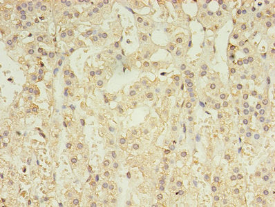 Immunohistochemistry of paraffin-embedded human adrenal gland tissue using GABRA4 Antibody at dilution of 1:100Rabbit anti-Human GABRA4 Polyclonal Antibody