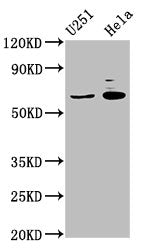 Western Blot  | Positive WB detected in: U251 whole cell lysate, Hela whole cell lysate  | All lanes: GABRA4 antibody at 7µg/ml  | Secondary  | Goat polyclonal to rabbit IgG at 1/50000 dilution  | Predicted band size: 62 kDa  | Observed band size: 62 kDaRabbit anti-Human GABRA4 Polyclonal Antibody