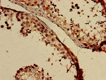 Immunohistochemistry of paraffin-embedded human testis tissue using GABRB3 Antibody at dilution of 1:100Rabbit anti-Human GABRB3 Polyclonal Antibody