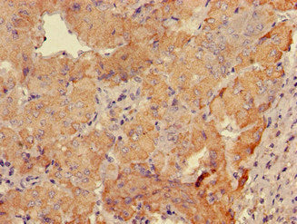 Immunohistochemistry of paraffin-embedded human adrenal gland tissue using GABRB3 Antibody at dilution of 1:100Rabbit anti-Human GABRB3 Polyclonal Antibody