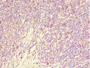 Immunohistochemistry of paraffin-embedded human thymus tissue using GABRR1 Antibody at dilution of 1:100Rabbit anti-Human GABRR1 Polyclonal Antibody