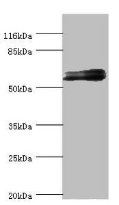 Western blot | All lanes: GABRR1 antibody at 1.25μg/ml + Mouse eye tissue | Secondary | Goat polyclonal to rabbit IgG at 1/10000 dilution | Predicted band size: 56, 54, 46 kDa | Observed band size: 56 kDaRabbit anti-Human GABRR1 Polyclonal Antibody