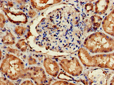Immunohistochemistry of paraffin-embedded human kidney tissue using ARF4 Antibody at dilution of 1:100Rabbit anti-Human ARF4 Polyclonal Antibody