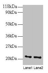 Western blot  | All lanes: ARF4 antibody at 2µg/ml  | Lane 1: EC109 whole cell lysate  | Lane 2: 293T whole cell lysate  | Secondary  | Goat polyclonal to rabbit IgG at 1/15000 dilution  | Predicted band size: 21 kDa  | Observed band size: 21 kDaRabbit anti-Human ARF4 Polyclonal Antibody