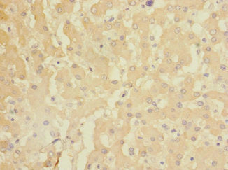 Immunohistochemistry of paraffin-embedded human liver tissue using GADD45G Antibody at dilution of 1:100Rabbit anti-Human GADD45G Polyclonal Antibody