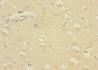 Immunohistochemistry of paraffin-embedded human brain tissue using GADD45G Antibody at dilution of 1:100Rabbit anti-Human GADD45G Polyclonal Antibody