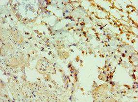 Immunohistochemistry of paraffin-embedded human epityphlon tissue using GAL Antibody at dilution of 1:100Rabbit anti-Human GAL Polyclonal Antibody