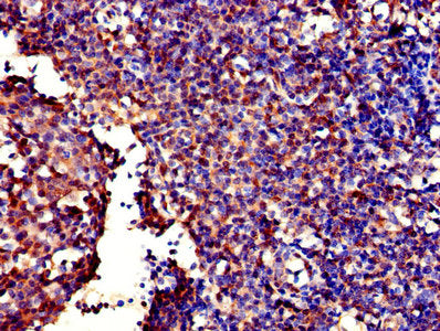 Immunohistochemistry of paraffin-embedded human tonsil tissue using the antibody at dilution of 1:100Rabbit anti-Human GALT Polyclonal Antibody