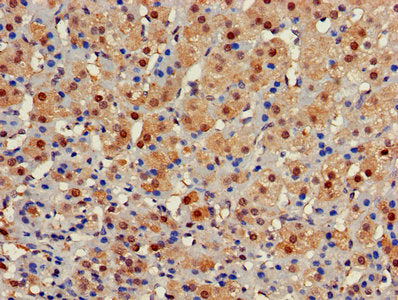 Immunohistochemistry of paraffin-embedded human adrenal gland tissue using GALT Antibody at dilution of 1:100Rabbit anti-Human GALT Polyclonal Antibody