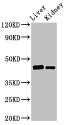 Western Blot  | Positive WB detected in: Rat liver tissue, Mouse kidney tissue  | All lanes: GALT antibody at 3µg/ml  | Secondary  | Goat polyclonal to rabbit IgG at 1/50000 dilution  | Predicted band size: 44, 32 kDa  | Observed band size: 44 kDaRabbit anti-Human GALT Polyclonal Antibody