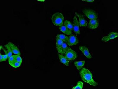 Immunofluorescent analysis of HepG2 cells using GARS Antibody at dilution of 1:100 and Alexa Fluor 488-congugated AffiniPure Goat Anti-Rabbit IgG(H+L)Rabbit anti-Human GARS Polyclonal Antibody