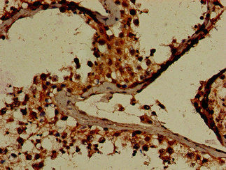 Immunohistochemistry of paraffin-embedded human testis tissue using GARS Antibody at dilution of 1:100Rabbit anti-Human GARS Polyclonal Antibody