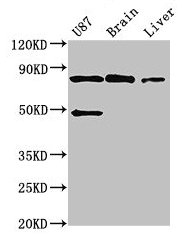 Western Blot | Positive WB detected in: U87 whole cell lysate, Mouse brain tissue, Mouse liver tissue | All lanes: GARS antibody at 3μg/ml | Secondary | Goat polyclonal to rabbit IgG at 1/50000 dilution | Predicted band size: 84 kDa | Observed band size: 84 kDaRabbit anti-Human GARS Polyclonal Antibody