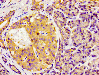 Immunohistochemistry of paraffin-embedded human pancreatic tissue using GAS1 Antibody at dilution of 1:100Rabbit anti-Human GAS1 Polyclonal Antibody