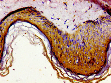Immunohistochemistry of paraffin-embedded human skin tissue using GAS1 Antibody at dilution of 1:100Rabbit anti-Human GAS1 Polyclonal Antibody