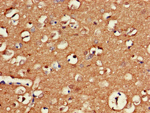 Immunohistochemistry of paraffin-embedded human brain tissue using GAS7 Antibody at dilution of 1:100Rabbit anti-Human GAS7 Polyclonal Antibody