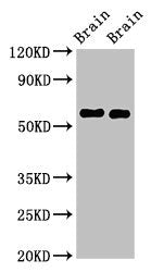 Western Blot | Positive WB detected in: Mouse brain tissue, Rat brain tissue | All lanes: GAS7 antibody at 2.5μg/ml | Secondary | Goat polyclonal to rabbit IgG at 1/50000 dilution | Predicted band size: 55, 48, 40 kDa | Observed band size: 55 kDaRabbit anti-Human GAS7 Polyclonal Antibody