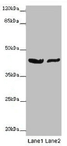 Western blot | All lanes: GATA1 antibody at 7μg/ml | Lane 1: MCF-7 whole cell lysate | Lane 2: A549 whole cell lysate | Secondary | Goat polyclonal to rabbit IgG at 1/10000 dilution | Predicted band size: 43, 36, 35 kDa | Observed band size: 43 kDaRabbit anti-Human GATA1 Polyclonal Antibody