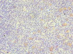 Immunohistochemistry of paraffin-embedded human tonsil tissue using GATA3 Antibody at dilution of 1:100Rabbit anti-Human GATA3 Polyclonal Antibody