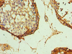 Immunohistochemistry of paraffin-embedded human testis tissue using GATA3 Antibody at dilution of 1:100Rabbit anti-Human GATA3 Polyclonal Antibody