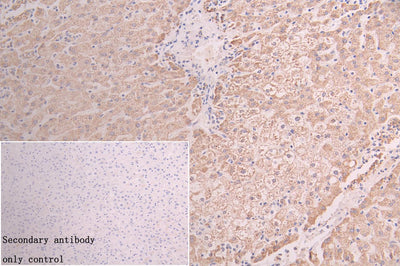 Immunohistochemistry of paraffin-embedded human liver tissue using GATM Antibody at dilution of 1:100