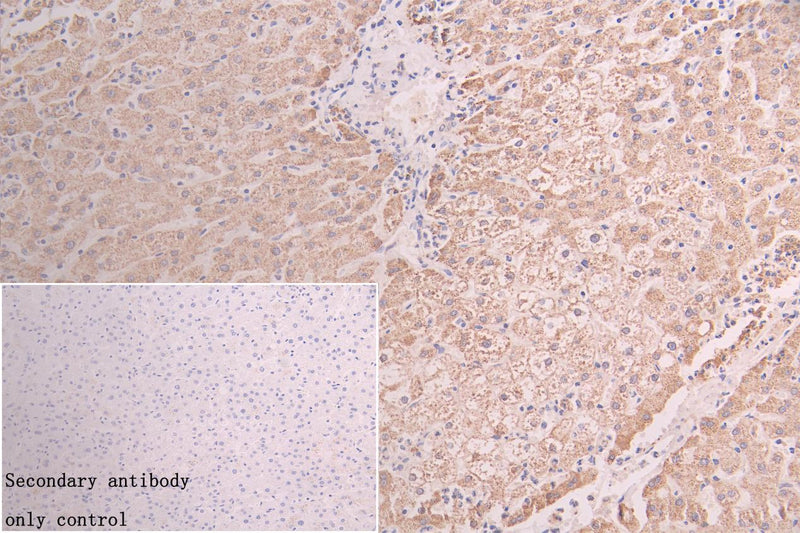 Immunohistochemistry of paraffin-embedded human liver tissue using GATM Antibody at dilution of 1:100