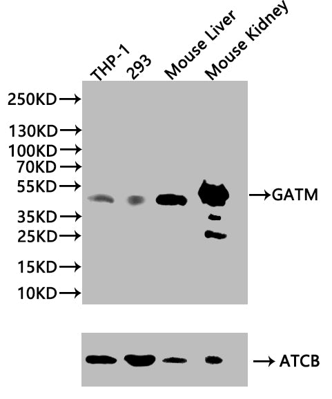 Western blot | All lanes: Glycine amidinotransferase, mitochondrial antibody at 2μg/ml + Mouse kidney tissue | Secondary | Goat polyclonal to rabbit IgG at 1/10000 dilution | Predicted band size: 49, 45 kDa | Observed band size: 49 kDa